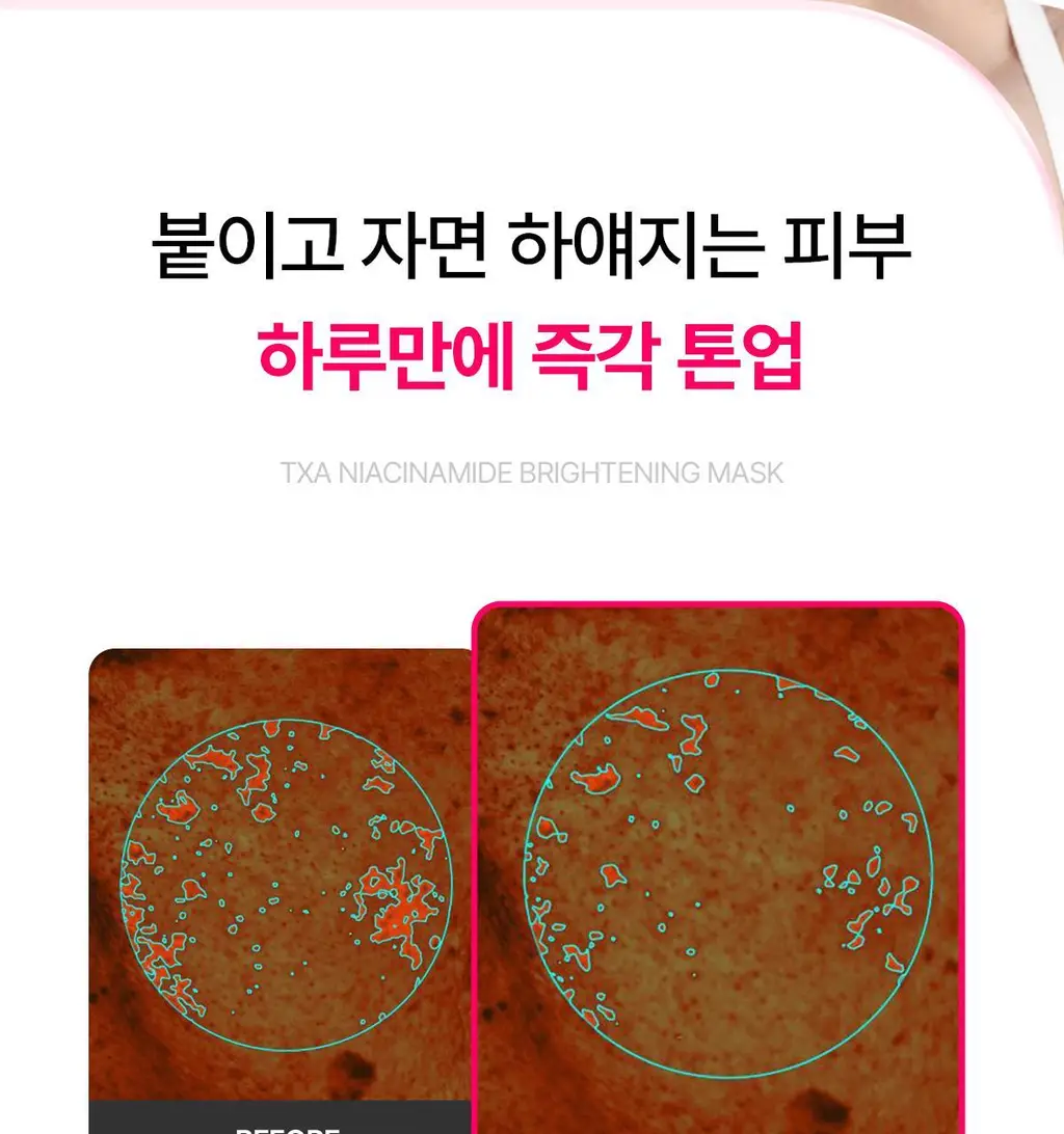 [박하선 PICK] 프롬메디 TXA 나이아신아마이드 브라이트닝 마스크 [1매/4매] 상세페이지 6